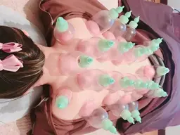 全身カッピングトリートメント 60分
