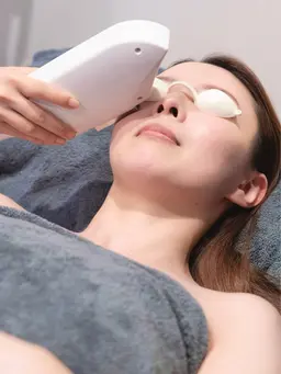 💎 顔脱毛▶ トーンUP＆化粧ノリ◎ 顔全体脱毛　¥4,000