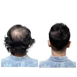 【顔出しNG】薄毛に悩む方のカット、シャンプー、ヘアセット。ホームページ、SNS等掲載用のお写真、動画の撮影。