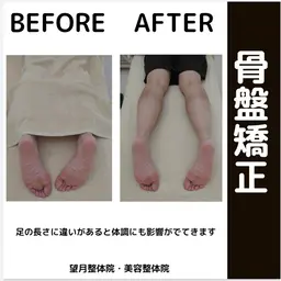 【美容整体(猫背➕骨盤)】整体・矯正 60分 ポキポキしない姿勢矯正!1回の施術で変わる!