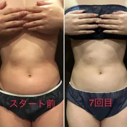 キャビテーションでリンパ流し！ついでに凝りともさよならしましょう😊60分コース