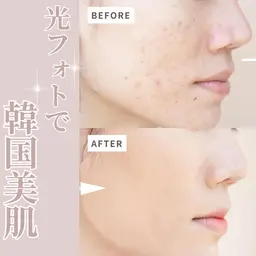 🎍✨【1月限定】くすみ・たるみ集中ケア✨🎍 🌈光フェイシャル × 💨水光エアバリ × ⚡EMS💎