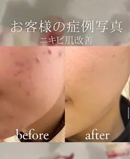 【人気No1】肌別ケア◎完全オーダーメイドフェイシャルエステ🌿