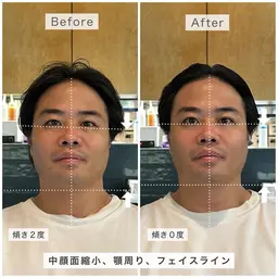 ととのう小顔 骨格補正スパ💆🏻♀️🫧 ※S.B込み