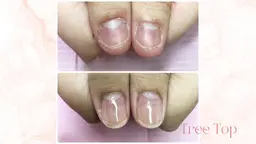 深爪矯正メニュー(ジェル)クリア仕上げ！！+1100円でカラー追加可能