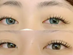 フラットラッシュ100本