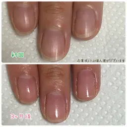 【隠す爪から魅せる爪に✨】育成ケア‪お試しコース🫶‪ෆ‪.*･ﾟ