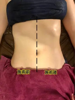 便秘解消　ぽっこりお腹　部分リリース