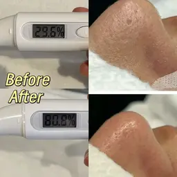 ☆美容皮膚科をサ口ン価額で実現☆シミケア小顔☆最新IPL光フエシャル&毛穴洗浄+デコルテ+イオン導入