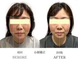【最先端技術】骨格から変わる！小顔矯正＋首肩矯正＋身体の歪み矯正