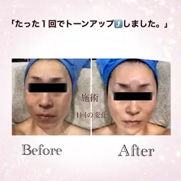 フェイシャルマッサージ