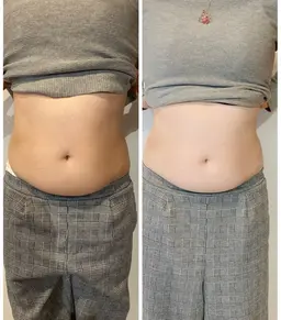 便秘下痢ぽっこりお腹に‼︎腸もみ整腸マッサージ