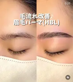 ハリウッドブロウリフト