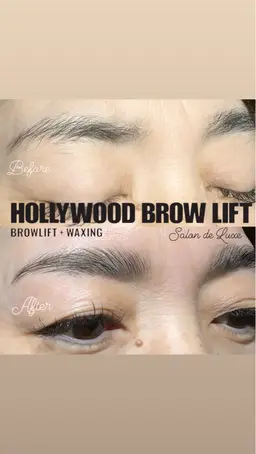 ハリウッドブロウリフト