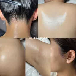 卒業旅行前に🧳 【2時間組み合わせ自由ワックス脱毛】※対象箇所指定有り※要確認