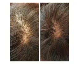 育毛ヘッドスパ&300本増毛エクステンション☆気軽に増毛体験☆