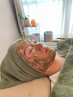 ハーブピーリング美容鍼