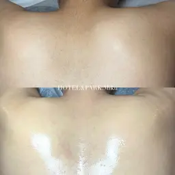 人気No.2❤️❄️【背中上*うなじ込ワックス脱毛】