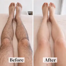 ⚡️4月限定⚡️新規様 【剃ってもすぐ生えるを卒業😳✨】 全身ツルスベ肌へ💖全身脱毛(顔・VIO込) 4,980円