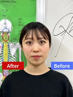 【お顔のお悩みに】小顔矯正☆エラ張り/横幅/左右差　30分 ¥8,800→¥6,600
