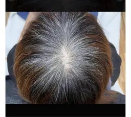 ☘️白髪染めリタッチ🩶