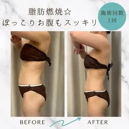 【深層リンパ×骨盤バランスケア】体質別リンパマッサージ90分（全身）