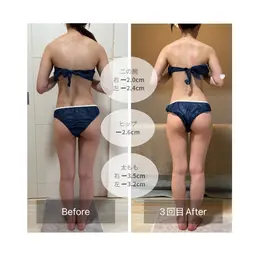 《仮予約》下半身45分｜美脚＆ヒップアップ集中ケア！ヒップラインをキュッと上向きに♪むくみや脚のだるさが気になる方にも◎