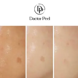 《ダクトピール》60分