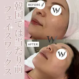 【新規価格で2回来店★】フェイシャルワックス(パック付き)2回分　¥15,000