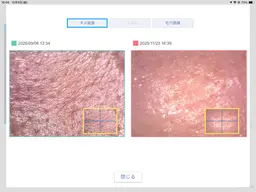 【🎓学割】オーダーメイド毛穴洗浄￥18700→4500 (黒ずみ・ニキビ・乾燥・汚れなど)