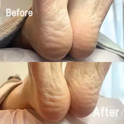 足裏角質除去／ファイリング ／甘皮処理【練習モニター】 ¥5980→¥1500  ※足裏や爪にトラブルがある方はNG