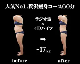 ★成功者続出サロン◎【太もも・ふくらはぎ・ヒップ】オーダーメイド痩身★下半身集中痩せ60分　2980円