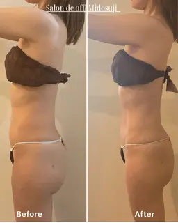 上半身📍痩身燃焼マッサージ❤️🔥