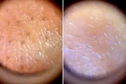 『SNSでも大人気✨』ルミスパ洗顔体験🫧