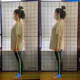『1月限定』姿勢美人コース✌️(猫背、骨盤矯正、マッサージ)60分当院のおすすめメニュー🎶
