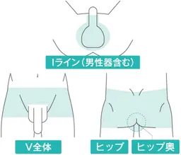 【初回限定】メンズ　VIO脱毛