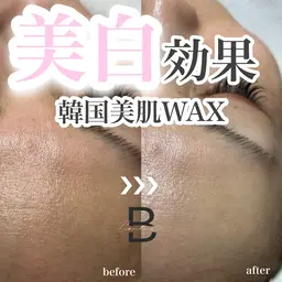 韓国美肌WAX脱毛🇰🇷💖