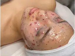 【八王子初】ハイドロジェリーマスク🪞