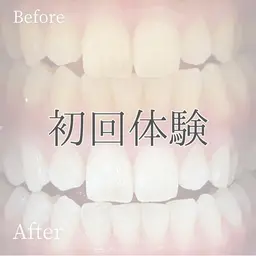 【ミニモ限定】うる艶美白歯🦷初回体験✨40分¥2000ホワイトニングデビューは当店におまかせ✨口コミ必須🫶