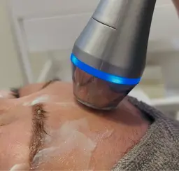 【最新機器】韓国式LDM小顔ケア