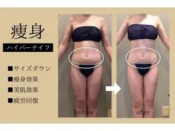 《お腹二の腕背中》ハイパーナイフ+マッサージ６０分￥13000→3500