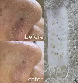 【限定9名】15分でできる毛穴矯正☆彡