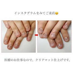 【ネイルNGなお仕事の方🍀】深爪矯正長さだし10本+クリア仕上げ(マット可)