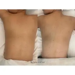 【ボディ】上半身オイルトリートメント🫧