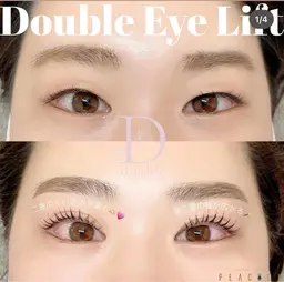 【先着5名限定】ダブルアイリフト(マッサージ、まつ毛パーマ)