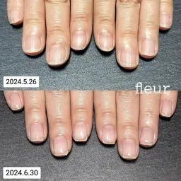 地爪育成(ジェル)オフ別途