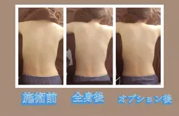 全身➕選べるオプション（バストアップorお腹痩せorお尻脚やせor小顔リフトアップ）⭐️