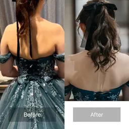 小顔矯正&天使の羽で、自分史上最高の自分へ!ブライダル矯正