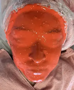 カスマラパック×毛穴洗浄付き✨🌙　SNS映え！話題のカラフルな謎なパック…！