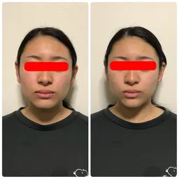 新規のお客様限定❗️小顔コース（90分）